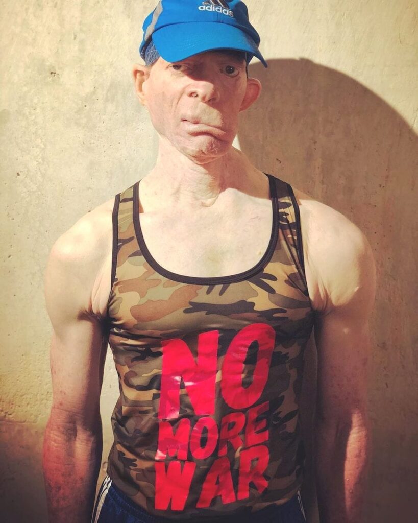 Dancehall Veteran Yellowman Is Not Pleased With Beenie Man's Remake Of "Zungguzungguguzungguzeng"