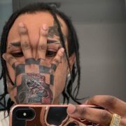 Tommy Lee Sparta Rushed To Hospital Amid Police Custody