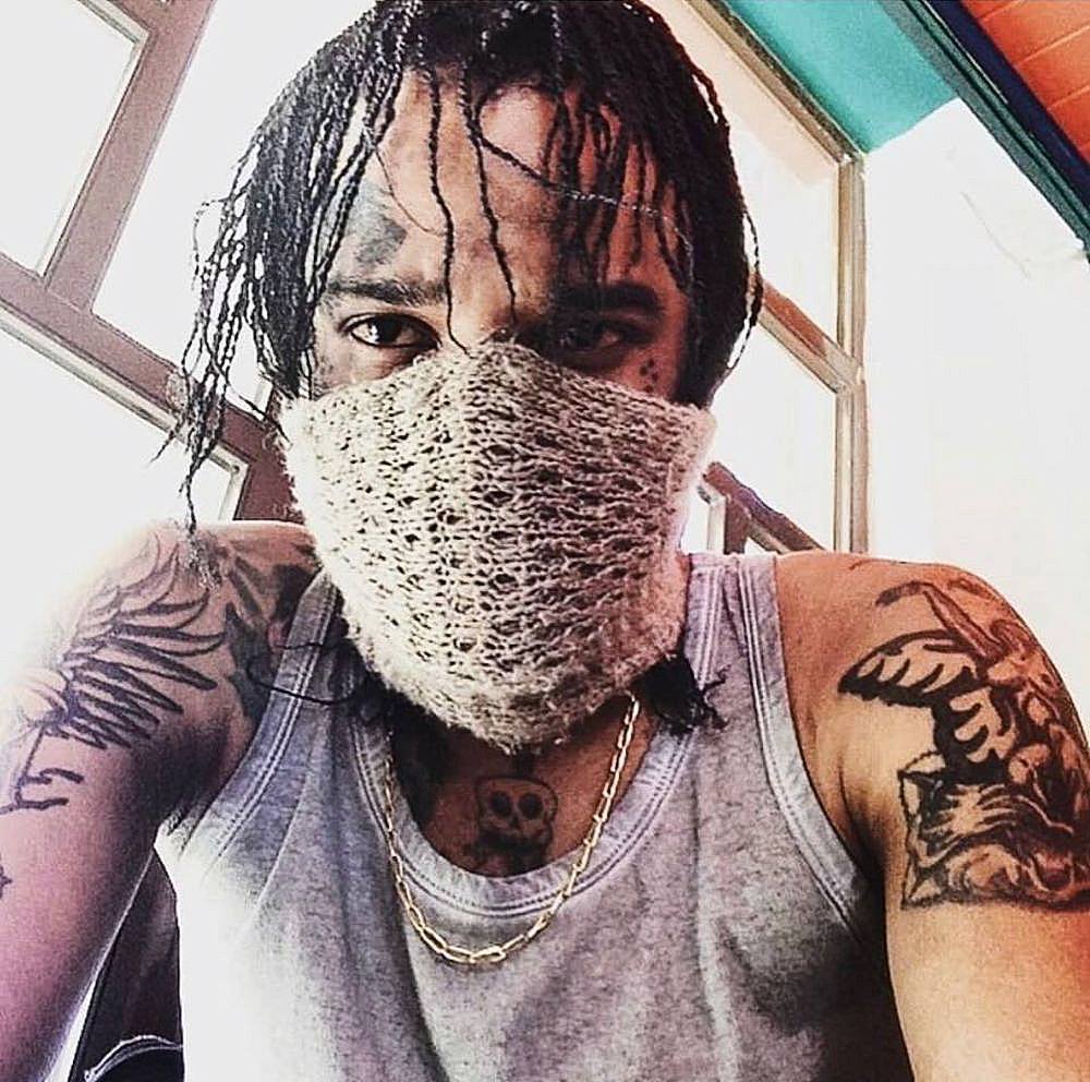 Tommy Lee Sparta Rushed To Hospital Amid Police Lockup